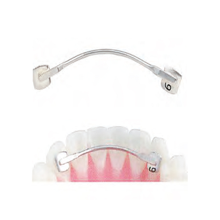 (Lingual Retainers (5 Sizes/ pack