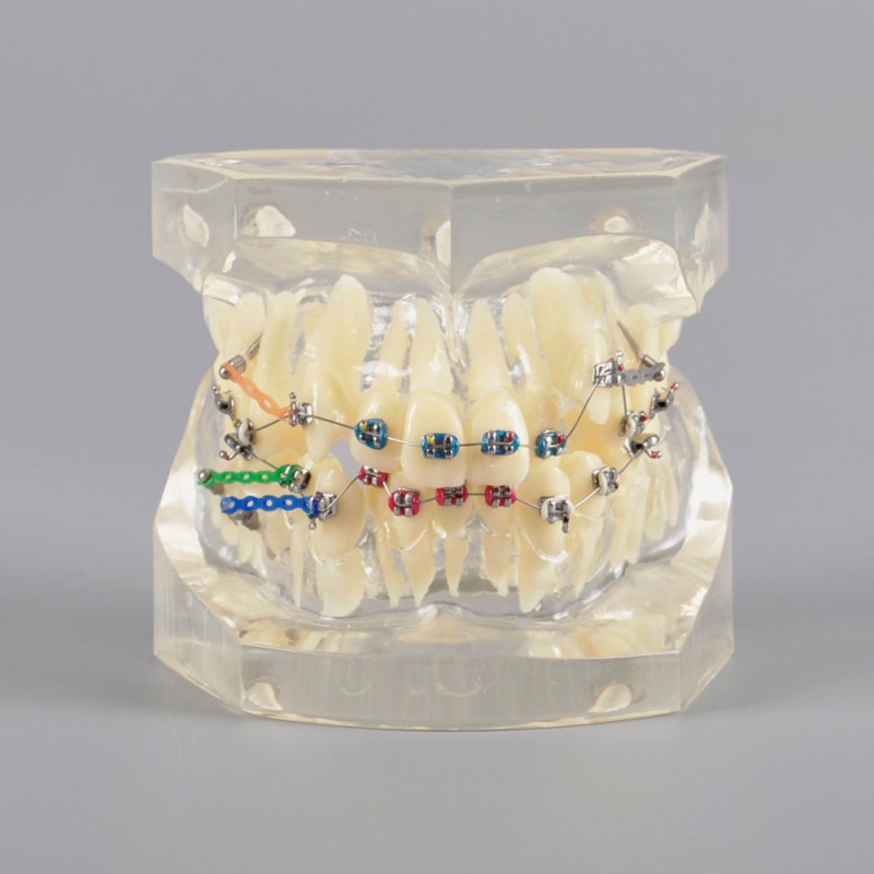 Ortho Cast Model - Clear