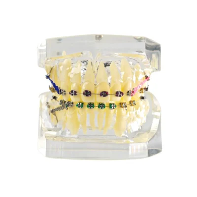 Ortho Cast Model – شفاف