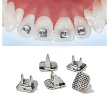 Tongue Spurs /Tammers – 10 قطع/عبوة